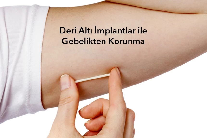 Deri Altı İmplantlar ile Gebelikten Korunma