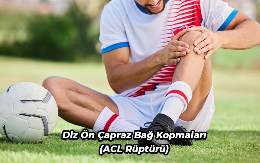 Diz Ön Çapraz Bağ Kopmaları (ACL Rüptürü)