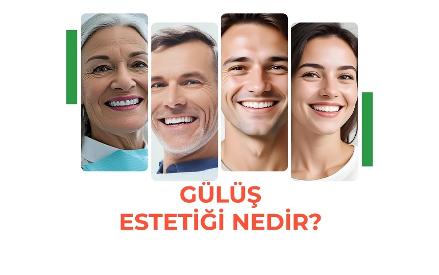 Gülüş Estetiği Nedir?